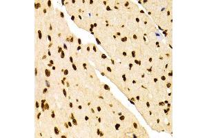 Immunohistochemistry of paraffin-embedded Mouse heart using DiMethyl-Histone H3-K27 antibody.