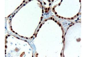 PAX8 polyclonal antibody  staining (3 ug/mL) of paraffin embedded human thyroid gland.