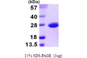 SOD-A (AA 1-206) protein (His tag)