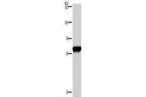 Western Blotting (WB) image for anti-Protein Phosphatase 3, Catalytic Subunit, alpha Isoform (PPP3CA) antibody (ABIN2429663) (PPP3CA anticorps)