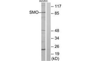 Western blot analysis of extracts from HuvEc cells, using SMO Antibody. (SMO anticorps  (AA 68-117))