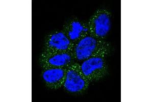 Confocal immunofluorescent analysis of NRAS Antibody (N-term) (ABIN392152 and ABIN2841877) with NCI- cell followed by Alexa Fluor 488-conjugated goat anti-rabbit lgG (green). (GTPase NRas anticorps  (N-Term))