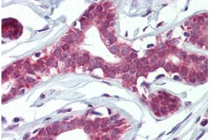Human Breast (formalin-fixed, paraffin-embedded) stained with ELF4 antibody ABIN462321 followed by biotinylated goat anti-rabbit IgG secondary antibody ABIN481713, alkaline phosphatase-streptavidin and chromogen.