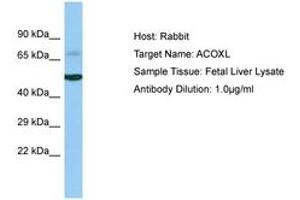 Image no. 1 for anti-Acyl-CoA Oxidase-Like (ACOXL) (AA 263-312) antibody (ABIN6750230) (ACOXL anticorps  (AA 263-312))