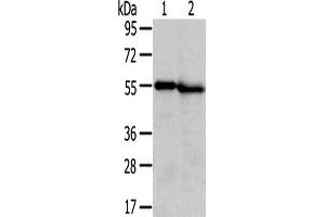 Gel: 8 % SDS-PAGE,Lysate: 40 μg,Lane 1-2: Human normal liver tissue, Human kidney tissue,Primary antibody: ABIN7131406(TMPRSS5 Antibody) at dilution 1/300 dilution,Secondary antibody: Goat anti rabbit IgG at 1/8000 dilution,Exposure time: 5 minutes (TMPRSS5 anticorps)