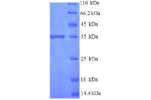 SDS-PAGE (SDS) image for Thioredoxin-Related Transmembrane Protein 3 (TMX3) (AA 25-195), (Isoform 2) protein (His-SUMO Tag) (ABIN5711652)