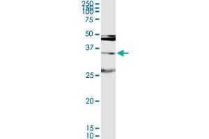 MAGEA9 MaxPab rabbit polyclonal antibody.