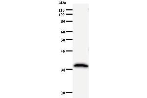 Western Blotting (WB) image for anti-Ubiquitin-Conjugating Enzyme E2K (UBE2K) antibody (ABIN931030) (UBE2K anticorps)