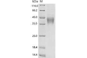 Natural Cytotoxicity Triggering Receptor 1 (NCR1) (AA 17-255) protein (His tag)