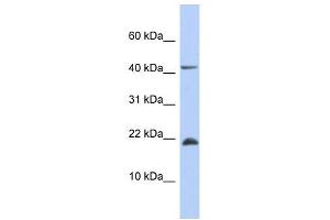 SFRS12IP1 antibody used at 1 ug/ml to detect target protein. (SFRS12IP1 anticorps  (Middle Region))