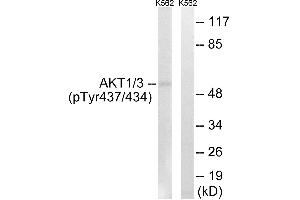 Immunohistochemistry analysis of paraffin-embedded human brain tissue using AKT1/3 (Phospho-Tyr437/434) antibody. (AKT1/3 (pTyr434), (pTyr437) anticorps)