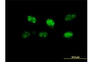 Immunofluorescence of purified MaxPab antibody to FBXO7 on HeLa cell.