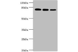 Western blot All lanes: X-ray repair cross-complementing protein 5 antibody at 2 μg/mL Lane 1: A549 whole cell lysate Lane 2: MCF-7 whole cell lysate Lane 3: 293T whole cell lysate Secondary Goat polyclonal to rabbit IgG at 1/10000 dilution Predicted band size: 83 kDa Observed band size: 83 kDa (XRCC5 anticorps  (AA 543-732))