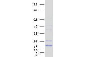 Validation with Western Blot (CUTA Protein (Transcript Variant 2) (Myc-DYKDDDDK Tag))