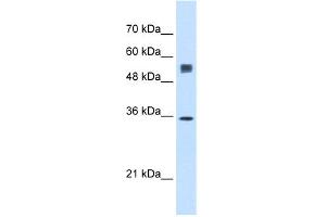 WB Suggested Anti-SSR1 Antibody Titration:  0. (SSR1 anticorps  (N-Term))