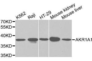 Western blot analysis of Y79 cell and Jurkat cell lysate using AKR1A1 antibody. (AKR1A1 anticorps  (AA 1-325))