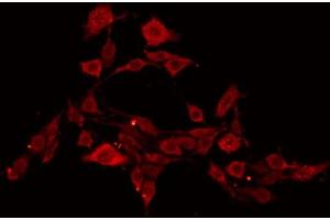 ABIN6269106 staining NIH-3T3 by IF/ICC. (EIF4E anticorps  (C-Term))