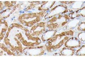 Immunohistochemistry of paraffin-embedded Mouse kidney using NUBP1 Polyclonal Antibody at dilution of 1:100 (40x lens).