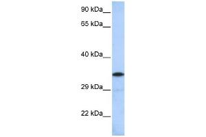 WB Suggested Anti-KCTD4 Antibody Titration:  0. (KCTD4 anticorps  (Middle Region))
