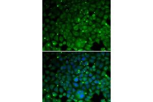 Immunofluorescence analysis of HeLa cells using CRYAA antibody. (CRYAA anticorps  (AA 1-173))
