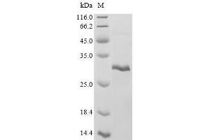 Metallothionein 3 (MT3) (AA 1-66), (full length) protein (His-SUMO Tag)