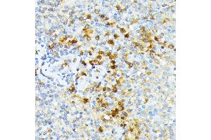 Immunohistochemistry of paraffin-embedded human tonsil using alpha 1 Spectrin antibody (ABIN6129333, ABIN6148401, ABIN6148402 and ABIN6215956) at dilution of 1:100 (40x lens).