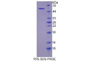 SDS-PAGE analysis of Human MYLK Protein. (MYLK Protéine)