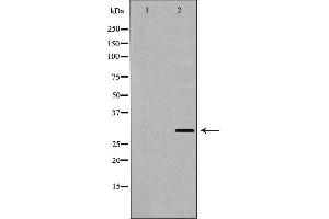 Western blot analysis of Hela whole cell lysates, using PSMF1 Antibody. (PSMF1 anticorps  (C-Term))