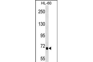 IL1RL2 Antibody (Center) 16964c western blot analysis in HL-60 cell line lysates (35 μg/lane). (IL1RAPL2 anticorps  (AA 376-405))