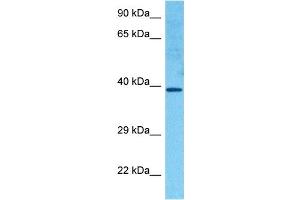 Host:  Rabbit  Target Name:  HOXC11  Sample Tissue:  Human RPMI 8226 Whole Cell  Antibody Dilution:  1ug/ml (HOXC11 anticorps  (Middle Region))