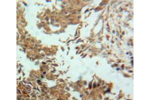 Used in DAB staining on fromalin fixed paraffin-embedded ovary tissue (ENPP2 anticorps  (AA 637-905))