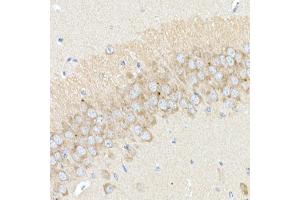 Immunohistochemistry of paraffin-embedded mouse hippocampus using B Rabbit pAb (ABIN6129977, ABIN6137413, ABIN6137415 and ABIN6220894) at dilution of 1:25 (40x lens).