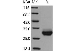 Western Blotting (WB) image for C-Reactive Protein (CRP) protein (His tag) (ABIN7194463) (CRP Protein (His tag))