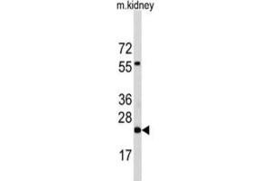 Western Blotting (WB) image for anti-Phosphatidylethanolamine N-Methyltransferase (PEMT) antibody (ABIN5015225) (PEMT anticorps)