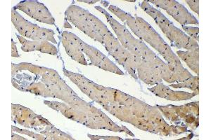 IHC analysis of Dnmt1 using anti-Dnmt1 antibody .