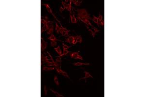 ABIN6268830 staining HeLa by IF/ICC. (FZD2 anticorps  (Internal Region))