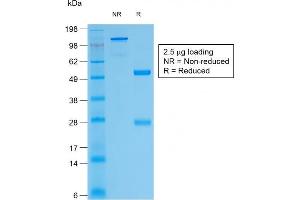 SDS-PAGE Analysis of Purified Thyroglobulin Rabbit Recombinant Monoclonal Antibody (TGB/1968R).