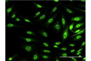 Immunofluorescence of monoclonal antibody to OXSR1 on HeLa cell. (OXSR1 anticorps  (AA 351-450))
