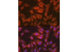 Immunofluorescence analysis of C6 cells using eEF2 Rabbit mAb (ABIN7267025) at dilution of 1:100 (40x lens).