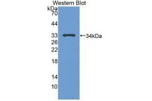Detection of Recombinant TP53, Human using Polyclonal Antibody to Tumor Protein p53 (P53)