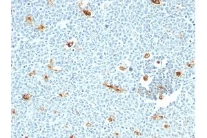 Formalin-fixed, paraffin-embedded human Tonsil stained with Macrophage Monoclonal Antibody (LN-5) (Macrophage / Histiocytoma Marker anticorps)
