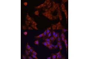 Immunofluorescence analysis of C6 cells using GANAB antibody  at dilution of 1:100. (GANAB anticorps  (AA 1-260))
