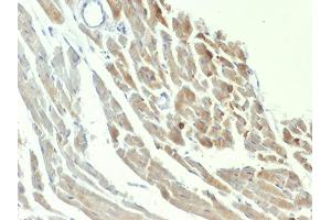 Formalin-fixed, paraffin-embedded Rat Heart stained with NSE gamma Mouse Monoclonal Antibody (ENO2/1375).