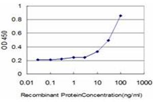 Detection limit for recombinant GST tagged DLD is approximately 1ng/ml as a capture antibody. (DLD anticorps  (AA 1-509))