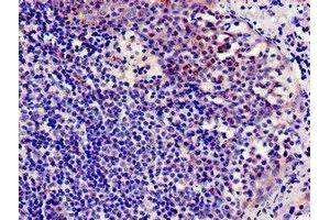 Immunocytochemistry analysis of human tonsil tissue using ABIN7145942 at dilution of 1:100 (CCR7 anticorps  (AA 332-378))