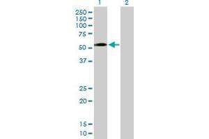 Western Blot analysis of ZNF563 expression in transfected 293T cell line by ZNF563 MaxPab polyclonal antibody. (ZNF563 anticorps  (AA 1-476))