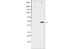 Western blot analysis of IKK-gamma expression in 293 whole cell lysates,The lane on the left is treated with the antigen-specific peptide.