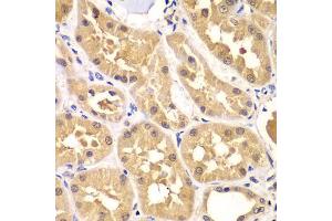 Immunohistochemistry of paraffin-embedded human kidney using PRKAG3 antibody (ABIN5975719) at dilution of 1/100 (40x lens). (PRKAG3 anticorps)
