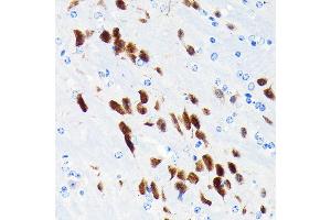 Immunohistochemistry of paraffin-embedded mouse brain using NeuN Rabbit mAb (ABIN7270098) at dilution of 1:100 (40x lens). (NeuN anticorps)