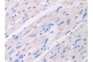 Detection of F5 in Mouse Heart Tissue using Polyclonal Antibody to Coagulation Factor V (F5)